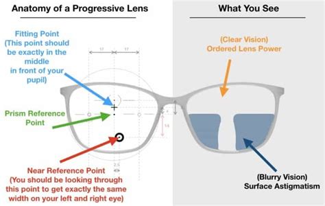 progressive lens problems.